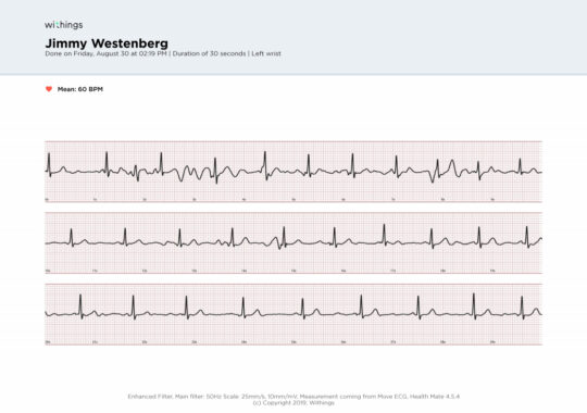 Withings Move ECG review: Heart not to recommend - Android Authority