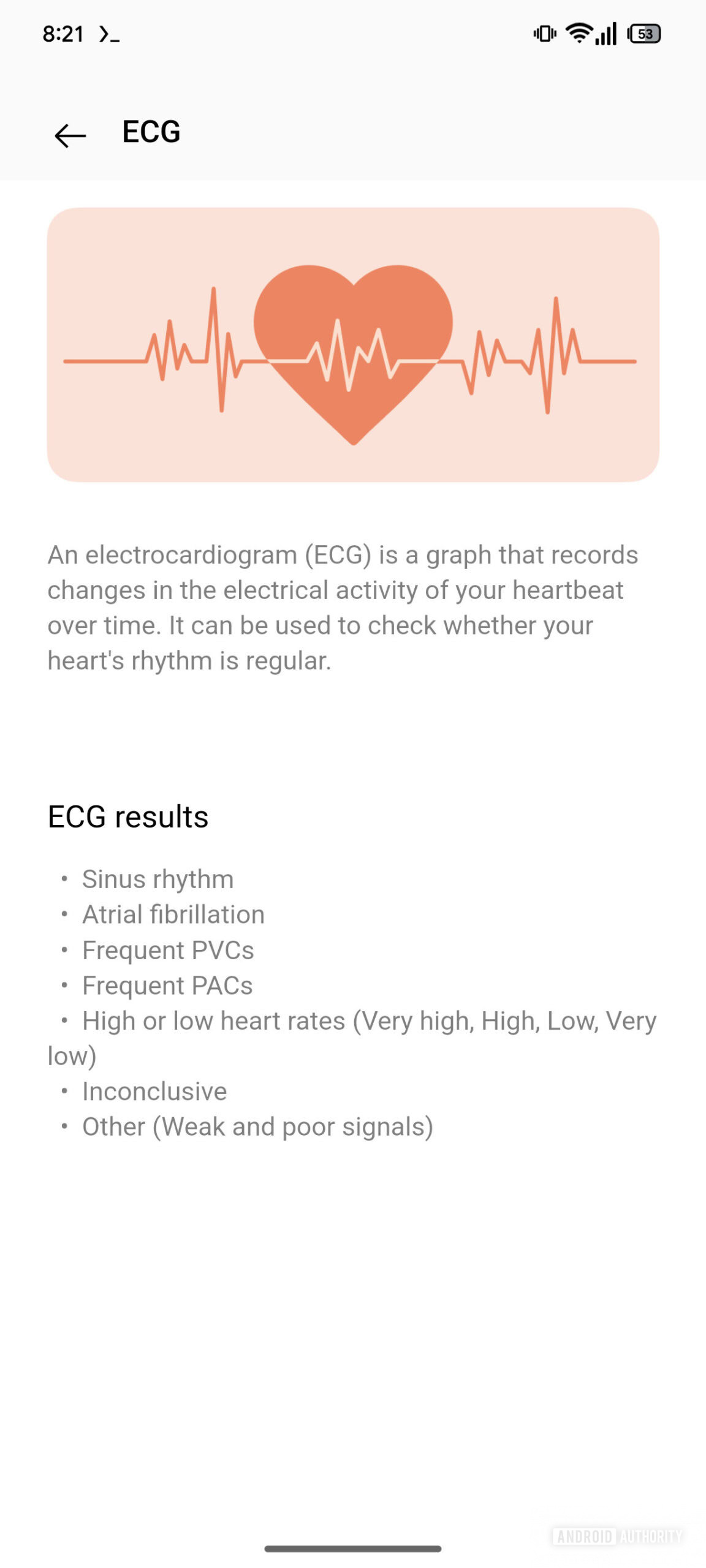 OHealth app ECG AssembleDebug 1